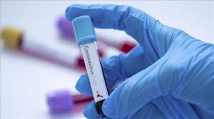 Chinese Expert Japan Drug Effective Against Covid 19