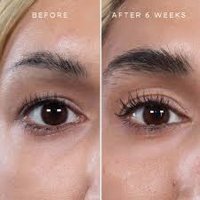 Common methods used to stimulate eyebrow growth include the supplement biotin, physical stimulation using a spoolie with some castor oil, and changing your diet. Top 5 Tips If You Re Losing Your Eyebrows