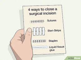 This can let bacteria grow and cause an infection. How To Take A Shower After Surgery With Pictures Wikihow