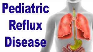 Image result for Pediatric Reflux