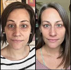 Theres just something about feelint confident in your skin again ✨ bonus if  your hair is growing and thriving too right?🥹 say DEETS ive got a suprise  👇🏻