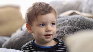 Miracle Paino baby marks milestone