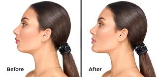 Excellent writing & presentation skills both in korean & english. Plastic Surgery Cost In South Korea Top Clinics And Best Plastic Surgeons