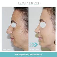 Doctor Javier Collado