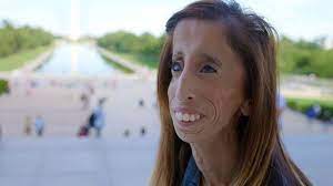 A retired police officer jason schechterle, while being at the service, survived a great tragedy. Lizzie Velasquez Online Bullies Called Me The World S Ugliest Woman Bbc News