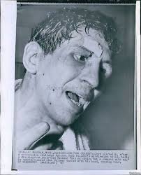 1960 Joey Giardello Claims Gene Fullmer Head Butted Him Sports Wirephoto  8X10