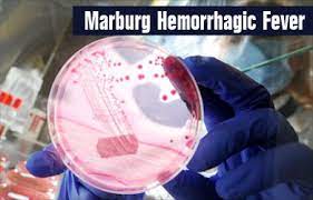 Marburg virus (marv) causes marburg virus disease in humans and nonhuman primates, a form of viral hemorrhagic fever. Marburg Virus Disease Causes Symptoms Diagnosis Treatment Prevention