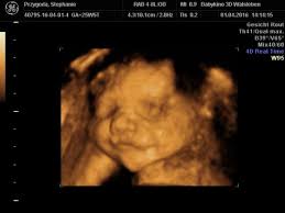 4d ultraschall nutzlich oder nur vergnugen baby und familie. Bilder Aus Der Kategorie 3d Und 4d Projekt Baby