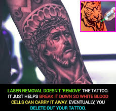 Non-laser tattoo removal methods and their effectiveness