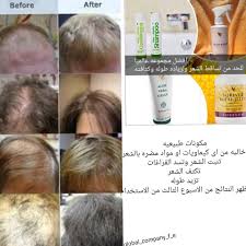 اذا كنت تعانى من تساقط الشعر فهذه المجموعه الحل الامثل ستوفر عليك تجربة اشياء كثيره بلافائده نتائجها مضمونه الاكثر مب Beauty Aloe Incoming Call Screenshot