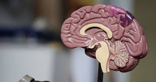 Alzheimer's disease damages the brain's intellectual… what can we help you find? Home Alzheimer Oberland