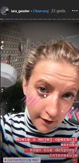 Nie wszyscy jednak doceniają urodę rihanny. Lara Gessler Przeszla Operacje Pierwszy Dzien Byl Bardzo Trudny Obcas Pl