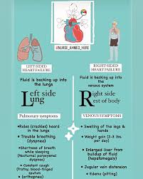 Image result for Right Heart Failure