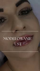 Modelowanie ust 💕 , #medycynaestetyczna #powiekszanieust #hialuronicacid  #modelowanieust