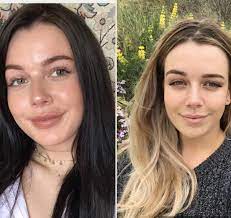 This means that naturally darker hair, like this darker base yanchuk 's own client started with, is more challenging to get to pale blonde. Do I Suit Blonde Or Dark Hair Would Love Opinions Hair