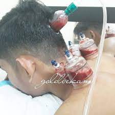 Bekam untuk lelaki dan wanita dengan kos rm5/cup semua peralatan klinik bekam shah alam ile bağlantı kurmak için şimdi facebook'a katıl. Gold Bekam Urut Shah Alam Home Facebook