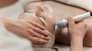 Also known as fordyce granules, fordyce's disease or fordyce lesion, fordyce spots are white or yellow bumps that appear on the lips in packs of between 20 and 100. How To Get Rid Of Fordyce Spots Conventional Treatment And Natural Remedies