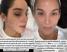 Paola di benedetto (vicenza, 8 gennaio 1995) è una showgirl e modella italiana. Paola Di Benedetto Il Prima E Il Dopo Colpisce I Fan
