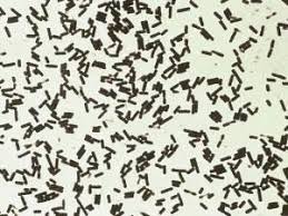 Most people infected with these bacteria do not get severe illness. Clostridium Perfringens Texas West Animal Health