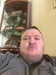 Why is my American Bulldog shedding excessively?