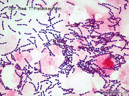 Maybe you would like to learn more about one of these? Diagnostik Universitatsklinikum Ulm