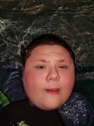 Special needs care for 3 year old?