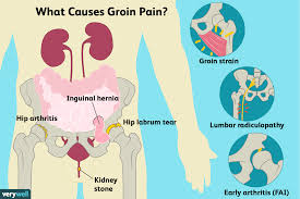 The groin is the area that lies between the abdomen stomach and thighs. Groin Pain Causes Treatment And When To See A Doctor