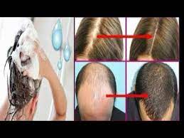 Seyrek Saci Tek Seferde Gurlestiren Dokulmeyi Durduran Kellige Son Veren Sampuan Yapimi Youtube Sac Saglikli Sac Dogal Sac Bakimi