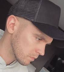 Gaz Beadle reveals all about his beard transplant after showing off new  facial hair to fans