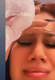 What Should I Do If I Ripoff My Nail But Its Still Partially Attached to  Nail Bed