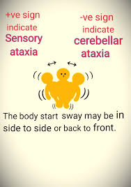 Image result for Romberg Test