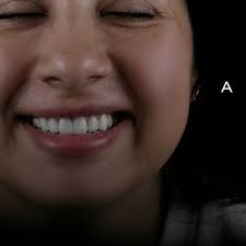 Diamonds Dental Clinic (@diamondsdental.clinic) · Tyre