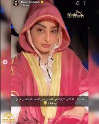 ريم عبدالله توضح سبب تغير ملامحها بعد اتهامها الصريح بإجراء تجميل. Ø¨Ø¹Ø¯ Ø®Ø¶ÙˆØ¹Ù‡Ø§ Ù„Ø¹Ù…Ù„ÙŠØ© ØªØ¬Ù…ÙŠÙ„ Ø¨Ø§Ù„Ø£Ù†Ù Ø§Ù„Ø¬Ù…Ù‡ÙˆØ± Ù„Ù€ Ø±ÙŠÙ… Ø¹Ø¨Ø¯ Ø§Ù„Ù„Ù‡ Ø§Ù„Ø®Ø´Ù… Ù„ÙŠØ´ ØµØ§Ø± Ø·ÙˆÙŠÙ„ Ø§Ù„ÙˆÙØ¯