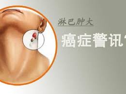 淋巴瘤（英文：lymphoma）又稱淋巴癌，是由淋巴細胞病變造成的 血液細胞瘤 （ 英語 ： blood cell tumors ） 。 此名稱被用來單指癌症形式，而非所有這類腫瘤。. æ·‹å·´è‚¿ç—›æ˜¯æ·‹å·´ç™Œå—