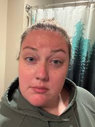 Don't worry about getting burned I got u with our after sun gel.