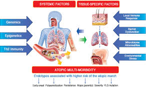 Image result for Allergic Triad