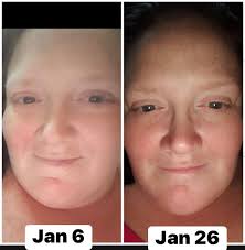 6 month difference and 45lbs in this photo! I'm currently 75lb down  naturally managing my PCOS insulin resistance 🩷💪🏽 If I can do it. So can  you! XO! IG- Kzeefitness (for my