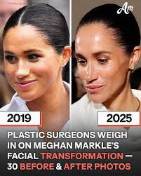 Meghan is the subject of speculation regarding her face, yet her fans agree  she is "still charming lady."😍 Her PHOTOS THEN & NOW.⬇️
