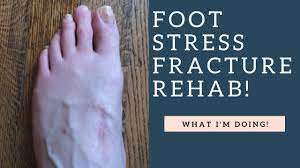 Life with a broken foot. Best Metatarsal Stress Fracture Rehab Exercises I Ve Been Doing How To Demo Youtube
