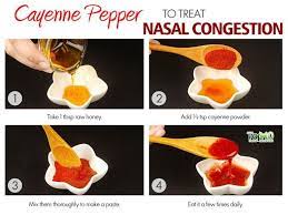 Home Remedies For Nasal Congestion Top 10 Home Remedies Cold Remedies Chest Congestion Remedies Cold Remedies Fast