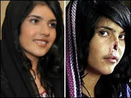 Aisha recuperó su nariz... y su sonrisa