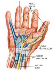 Apa Itu Carpal Tunnel Syndrome Dan Simptom Simptom