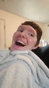 Surgery tomorrow at 8:30 AM. Looking forward to being