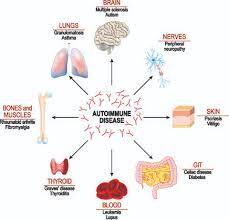 Anderson Wellness Care Chiropractor In San Diego Ca
