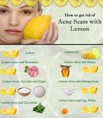 Pin On Home Remedies