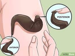 How To Kill Leeches: 12 Steps (With Pictures) - Wikihow
