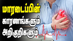 Tamil nadu chief minister j jayalalithaa was admitted to the hospital on september 22 after she complained of fever and dehydration. Heart Attack Symptoms And Reasons In Tamil Heart Attack Symptoms Heart Attack Symptoms
