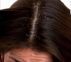 تفسير رؤية قشرة الشعر في المنام لابن شاهين موسوعة طيوف