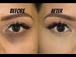 To use, twist the end of the concealer pen to release the formula onto the applicator. How To Cover Dark Circles And Bags Under Eyes How To Color Correct Eman Youtube Covering Dark Circles Concealer For Dark Circles Dark Eye Circles