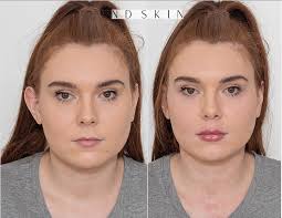 THE ESSENTIAL LIP ENHANCEMENT GUIDE